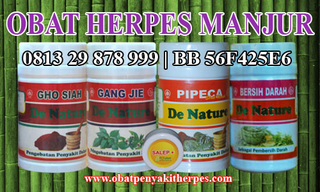 Illustration for article titled Pengobatan Penyakit Herpes Kelamin